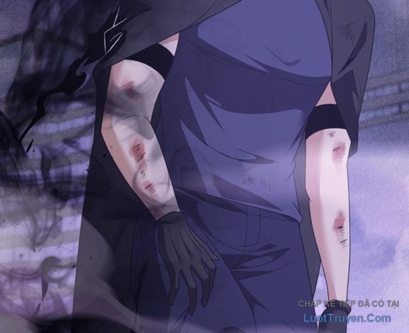 Ta Học Trảm Thần Trong Bệnh Viện Tâm Thần Chap 296 - Next Chap 295