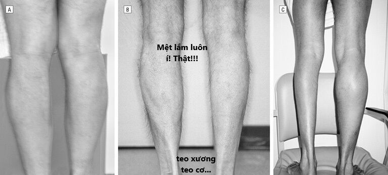 Ngay Cả Khi Hậu Tận Thế Thật Hạnh Phúc Khi Vẫn Còn Được Sống... (Puchimasu Miếu) [Chap 0.3-51.1]