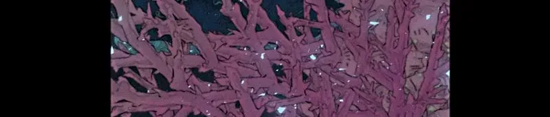 Hội Chứng Mẫn Cảm Cao Chương 3 - Trang 50